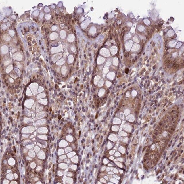 Anti-RBBP8 antibody produced in rabbit