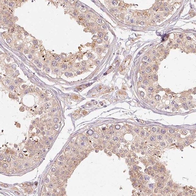 Anti-RB1CC1 antibody produced in rabbit
