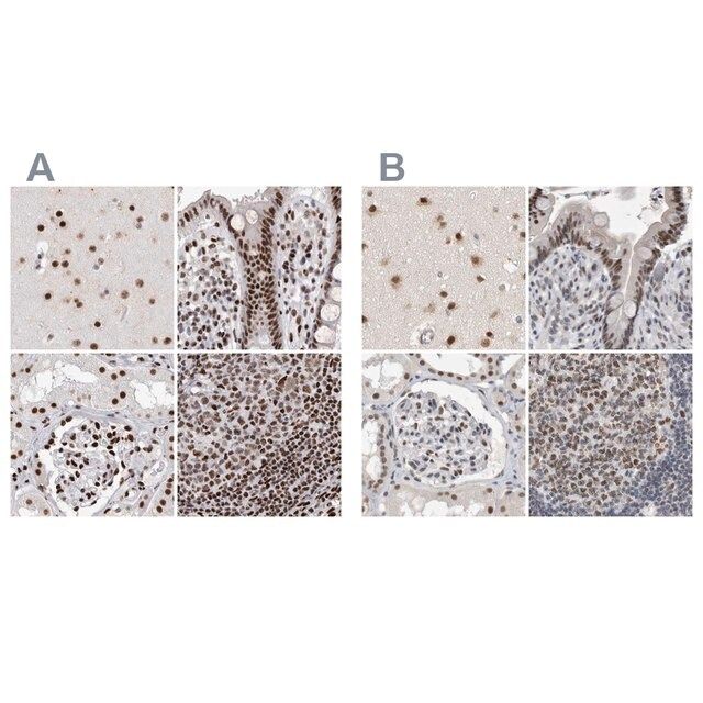 Anti-RBM6 antibody produced in rabbit
