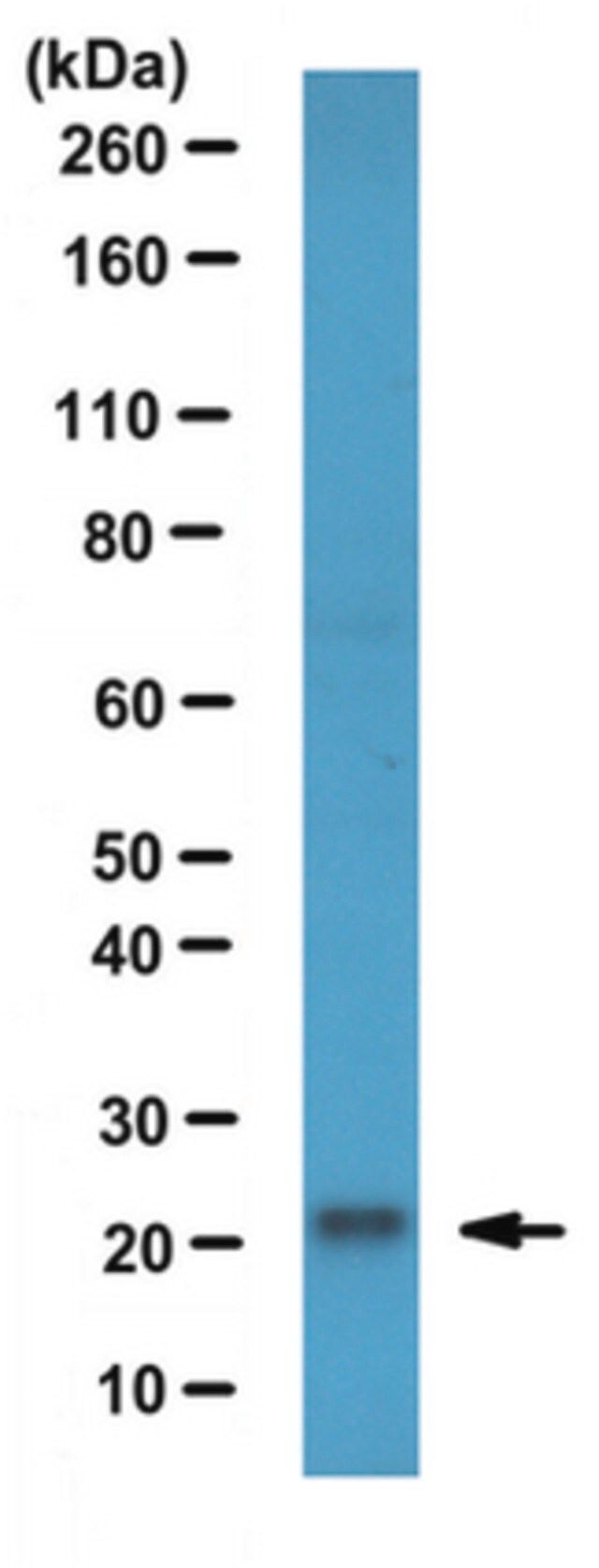Anti-RBP4 Antibody