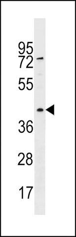 ANTI-RBMXL1 (CENTER) antibody produced in rabbit