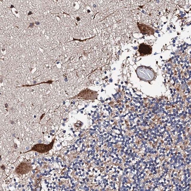 Anti-RCBTB2 antibody produced in rabbit
