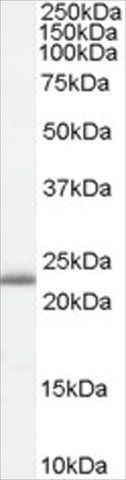 Anti-RBP4 (Internal) antibody produced in goat