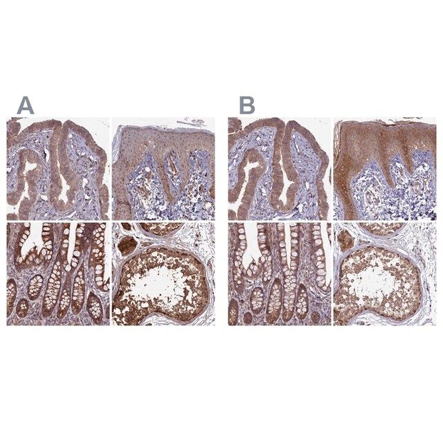 Anti-RCCD1 antibody produced in rabbit