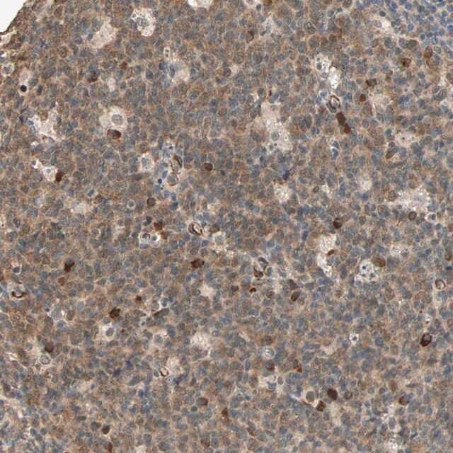 Anti-QSER1 antibody produced in rabbit