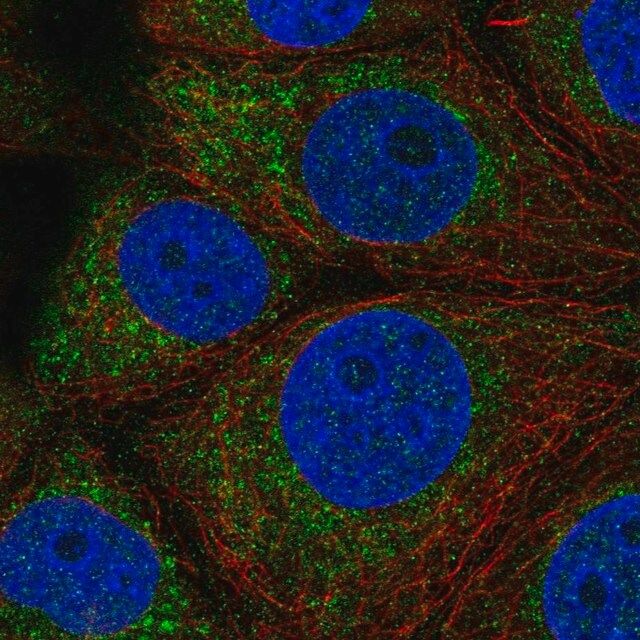 Anti-QTRT1 antibody produced in rabbit