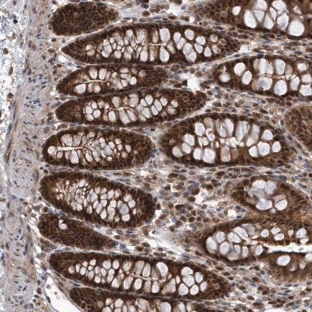 Anti-QTRT2 antibody produced in rabbit