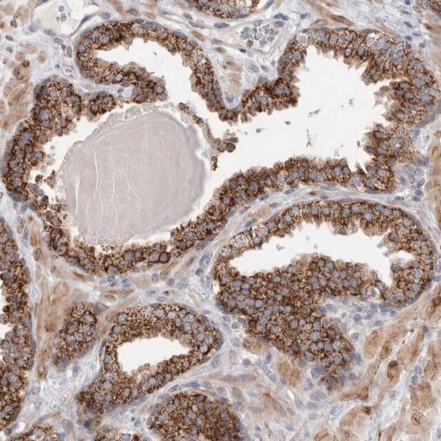 Anti-Rab18 antibody produced in rabbit