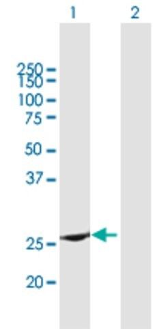 Anti-RAB37 antibody produced in mouse