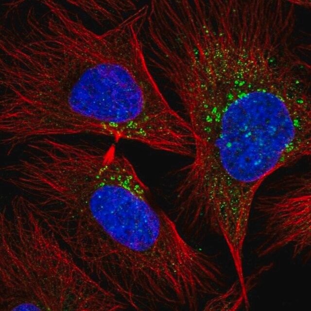 Anti-RAB20 antibody produced in rabbit