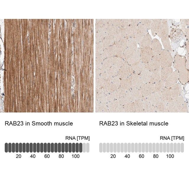Anti-RAB23 antibody produced in rabbit