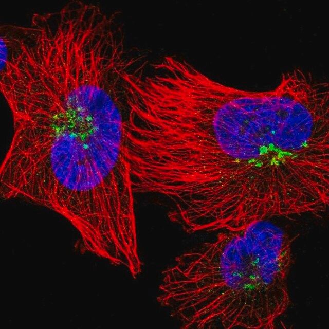 Anti-QSOX1 antibody produced in rabbit