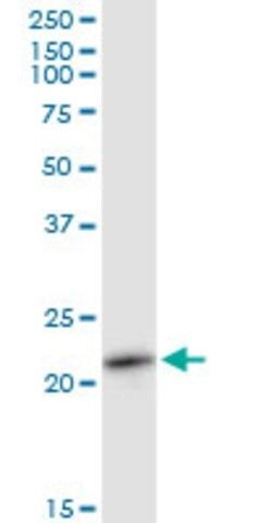 Anti-RAB11A antibody produced in mouse