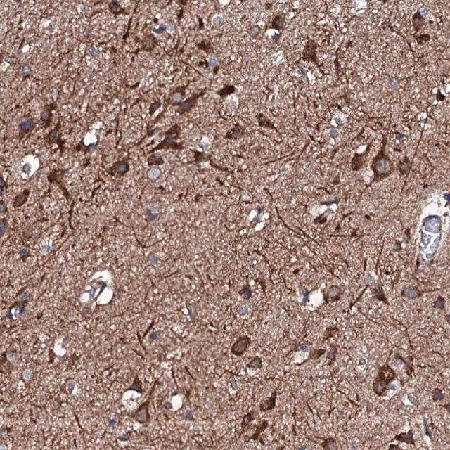 Anti-RAB12 antibody produced in rabbit