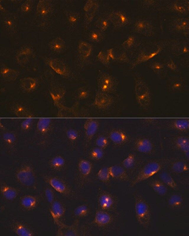 Anti-RAB11A antibody produced in rabbit