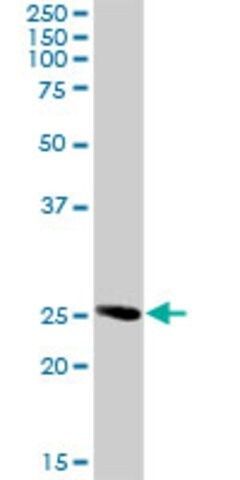 Anti-Rab32 antibody produced in rabbit