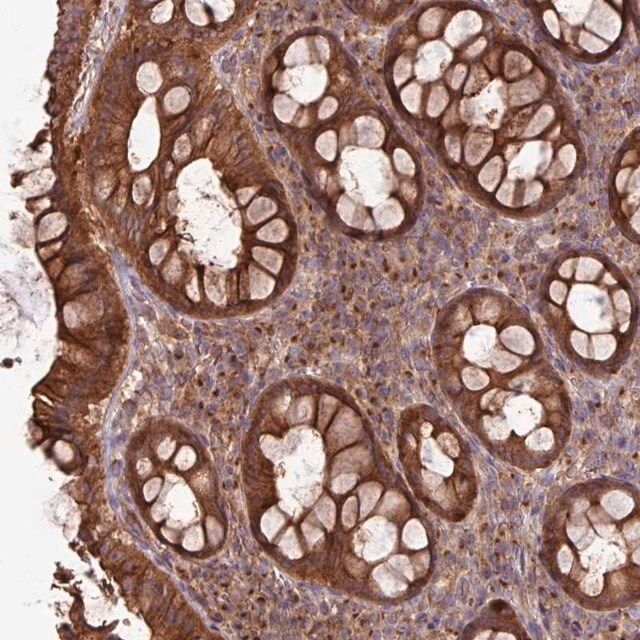Anti-RAB19 antibody produced in rabbit