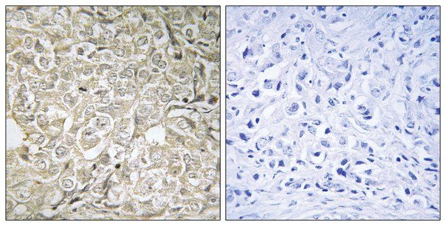 Anti-RAB37 antibody produced in rabbit