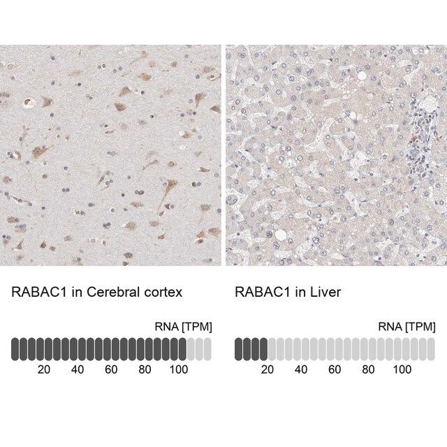 Anti-RABAC1 antibody produced in rabbit