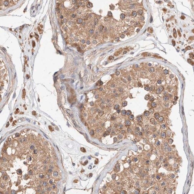 Anti-Rab14 antibody produced in rabbit