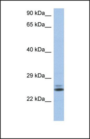 Anti-RAB15, (N-terminal) antibody produced in rabbit