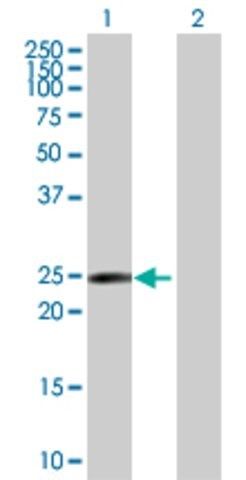 Anti-RAB17 antibody produced in rabbit