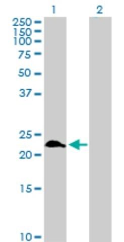 Anti-RAB9A antibody produced in rabbit