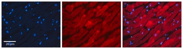 Anti-RAB11A (C-terminal) antibody produced in rabbit