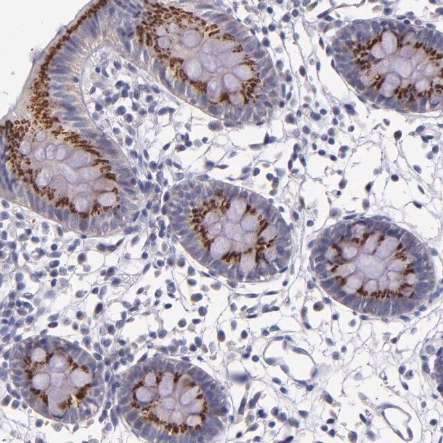 Anti-RAB41 antibody produced in rabbit