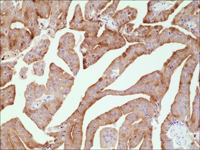 Anti-PSA (Prostate Specific Antigen) antibody, Rabbit monoclonal