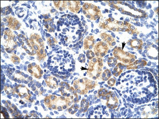 Anti-P2RX7 antibody produced in rabbit
