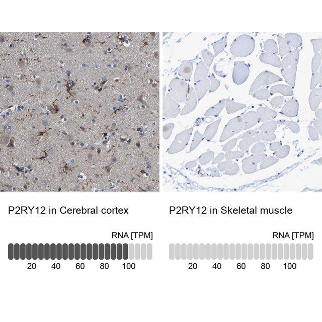 Anti-P2RY12 antibody produced in rabbit