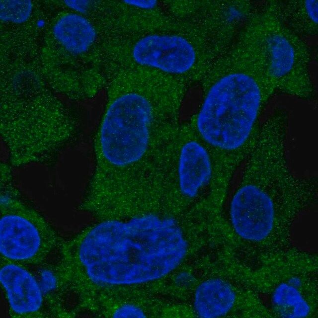 Anti-PSAT1 antibody produced in rabbit