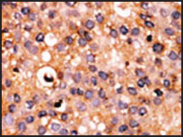 Anti-PSKH1 (N-term L9) antibody produced in rabbit