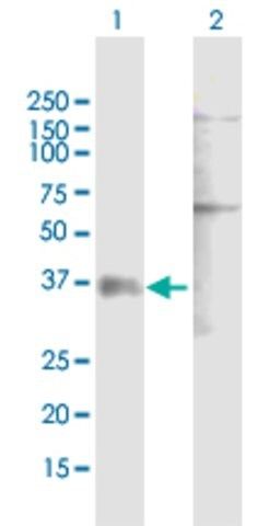 Anti-P2RY1 antibody produced in mouse