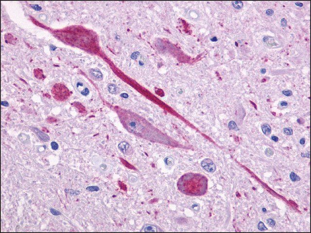 Anti-P2RY14 / P2Y14 antibody produced in rabbit