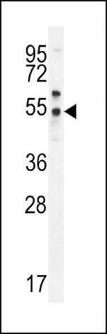 ANTI-PSMAL (C-TERM) antibody produced in rabbit