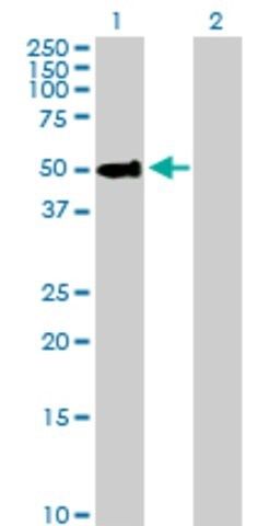 Anti-PSAP antibody produced in rabbit