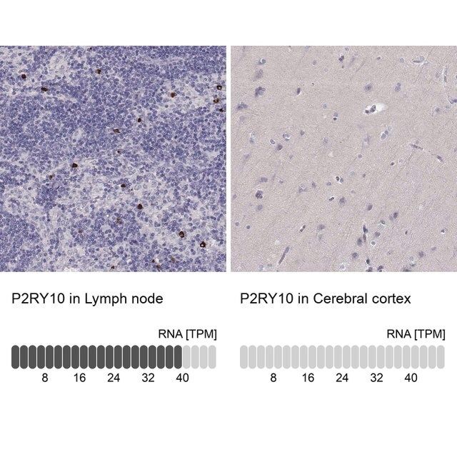 Anti-P2RY10 antibody produced in rabbit