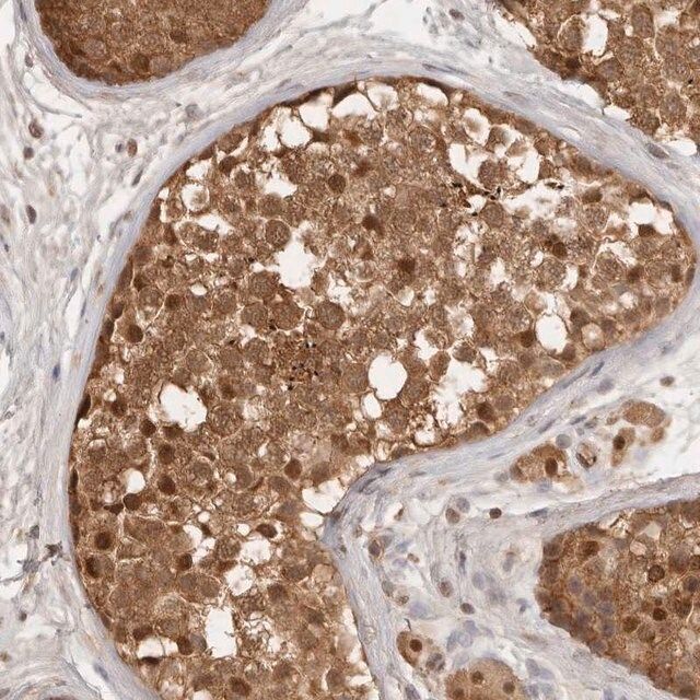 Anti-PSMA5 antibody produced in rabbit