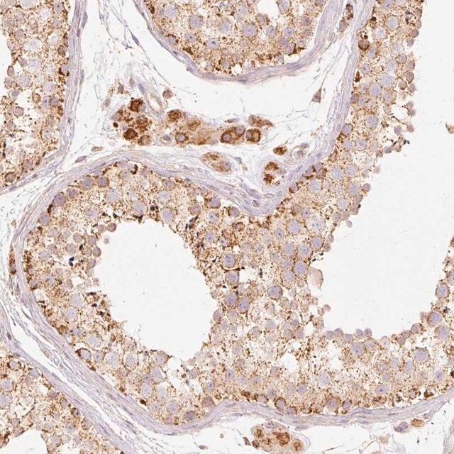 Anti-PSENEN antibody produced in rabbit