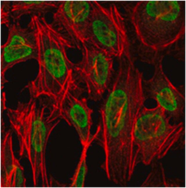 Anti-PSIP1 Antibody, clone 6E4