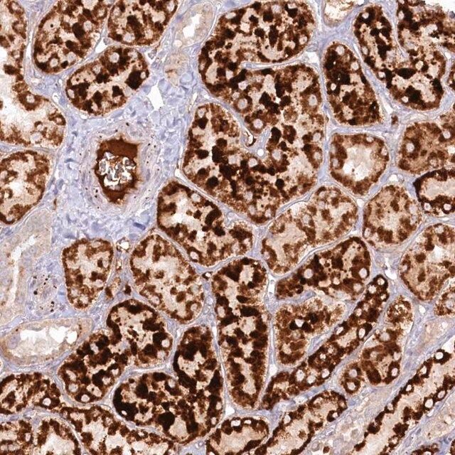 Anti-PSAPL1 antibody produced in rabbit