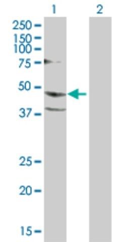 Anti-PSCD1 antibody produced in rabbit