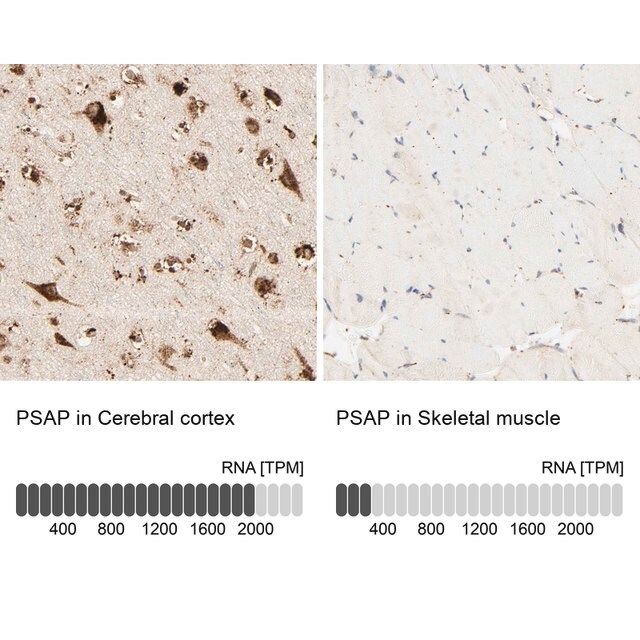 Anti-PSAP antibody produced in rabbit