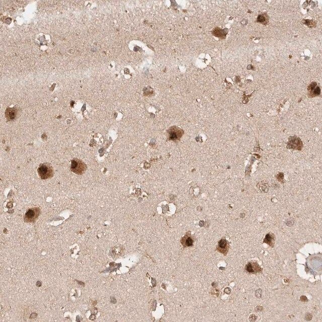 Anti-PSMA5 antibody produced in rabbit
