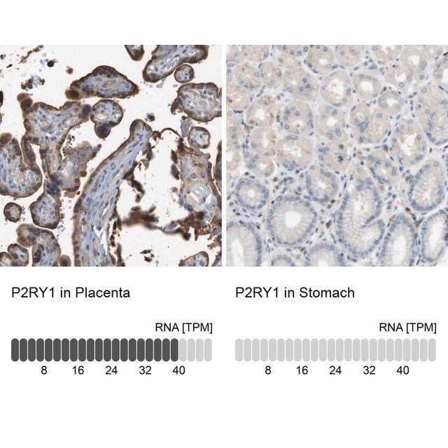 Anti-P2RY1 antibody produced in rabbit