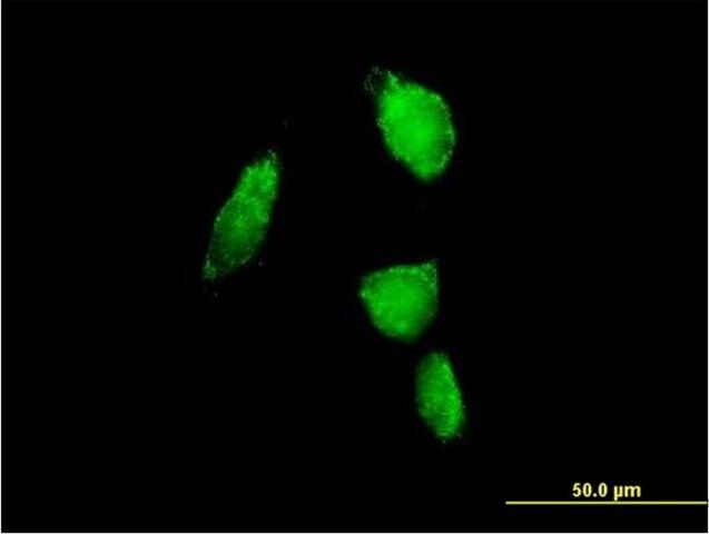 Anti-PSMA6 antibody produced in mouse