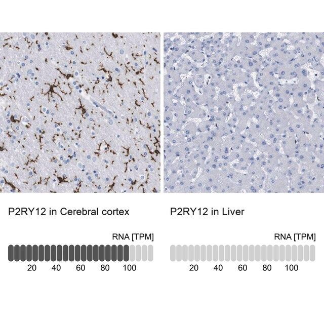 Anti-P2RY12 antibody produced in rabbit