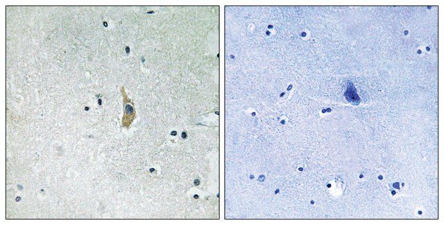 Anti-PSEN1 antibody produced in rabbit